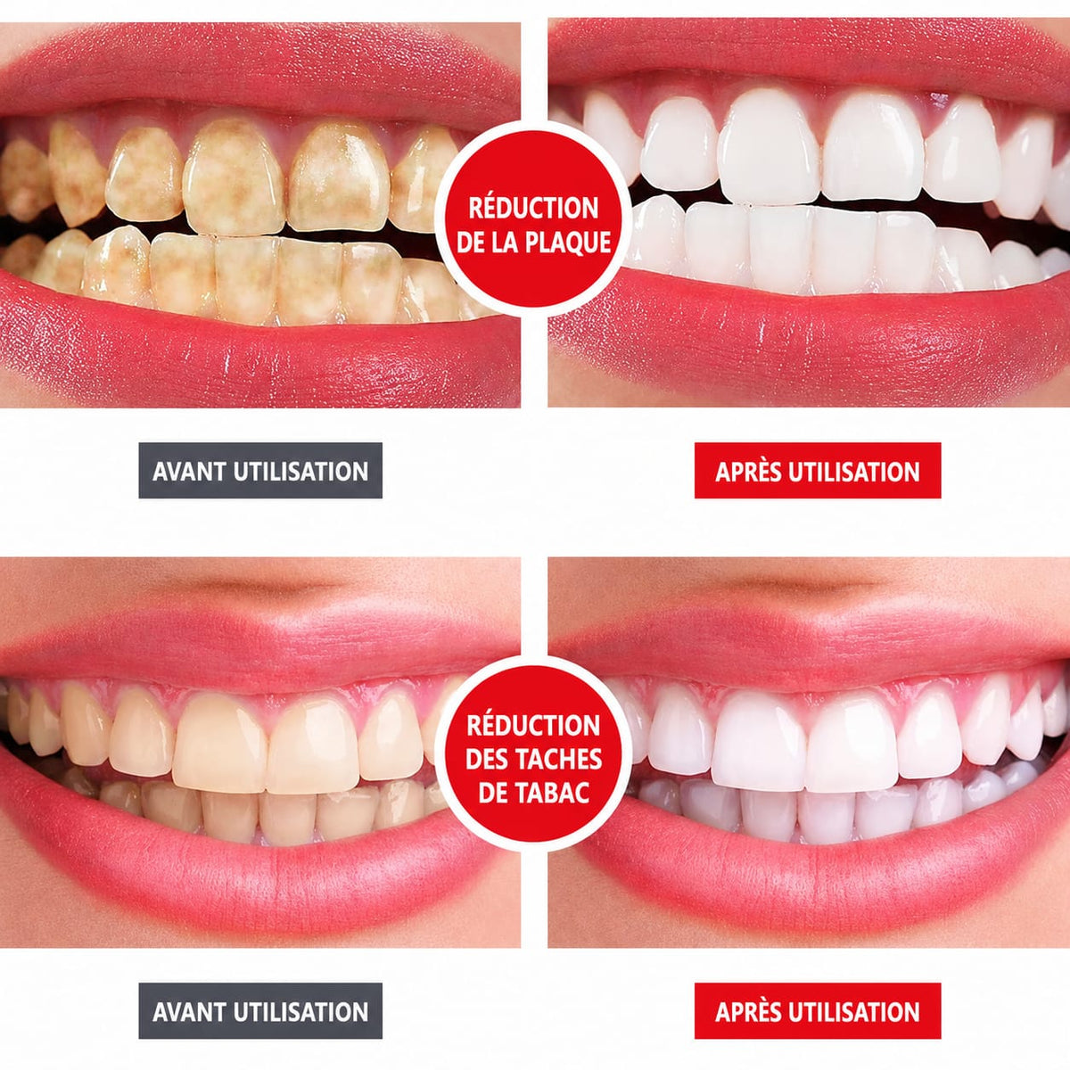 YAYASHI SP-4 - Dentifrice blanchissant et rafraîchissant.